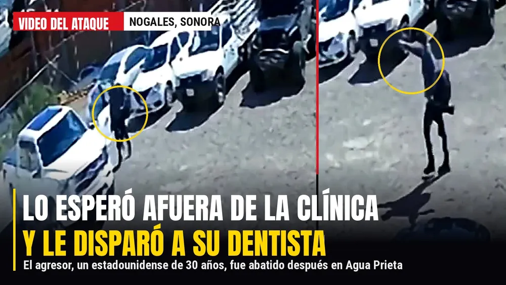 ABATE A DENTISTA SONORA