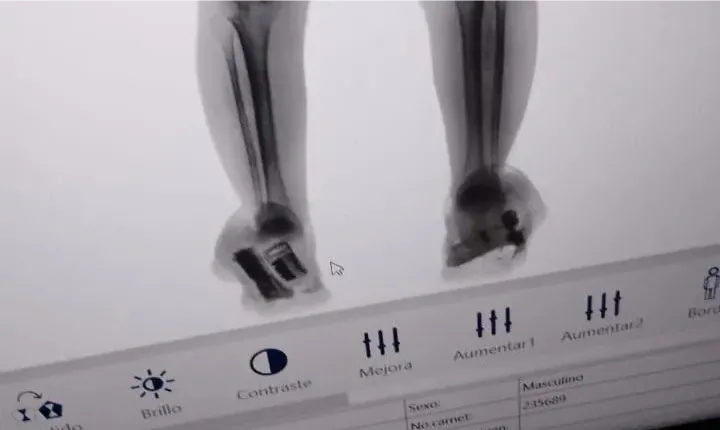 EVITAN INGRESO DE ARMA2