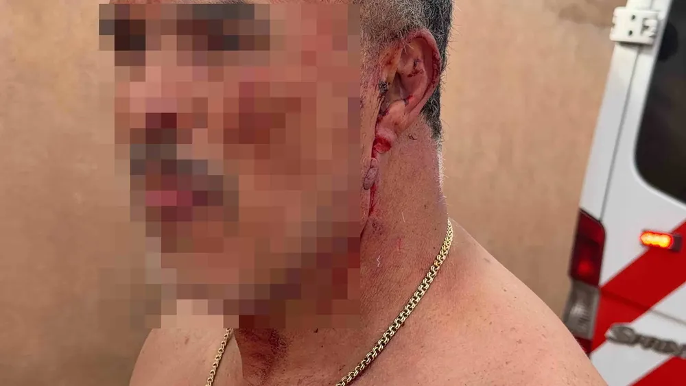 LESIONADO CUELLO BOTELLA2
